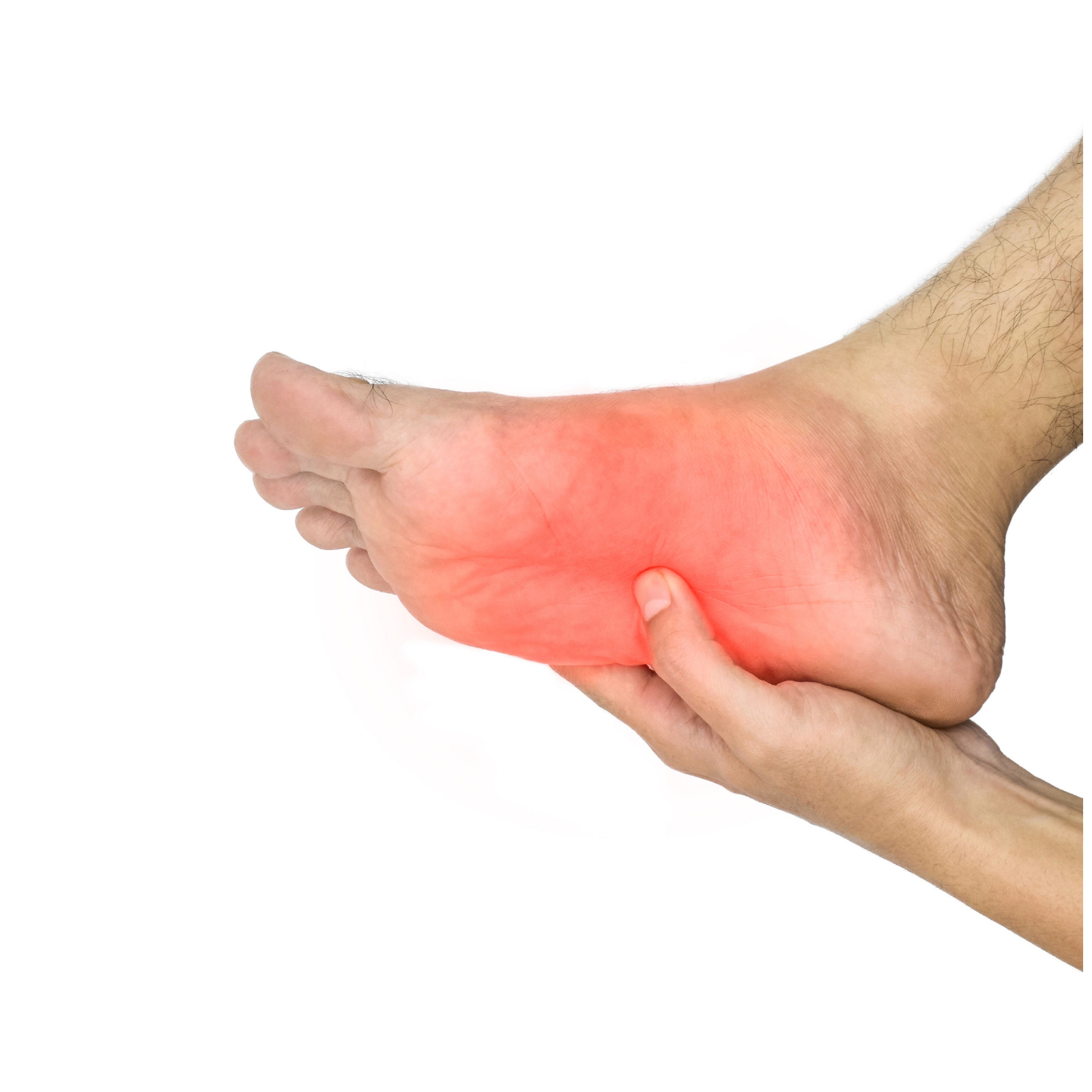 plantar fasciitis women